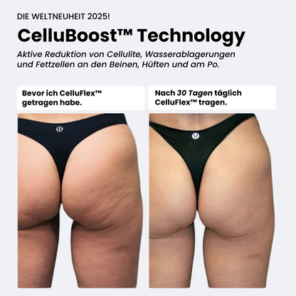 COREEX CelluFlex™ 3D-Kompressionsshorts