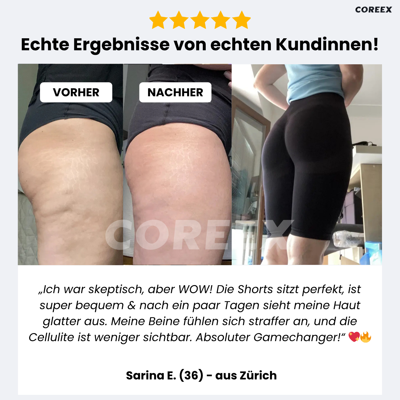 COREEX CelluFlex™ 3D-Kompressionsshorts