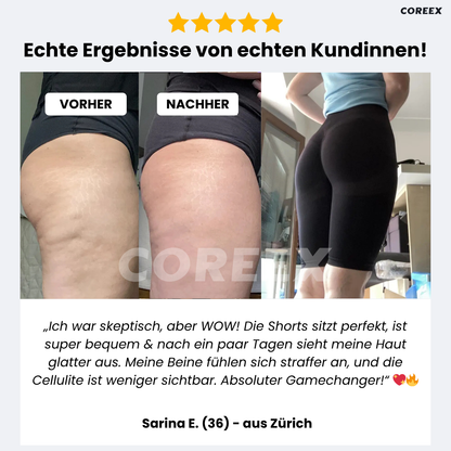 COREEX CelluFlex™ 3D-Kompressionsshorts