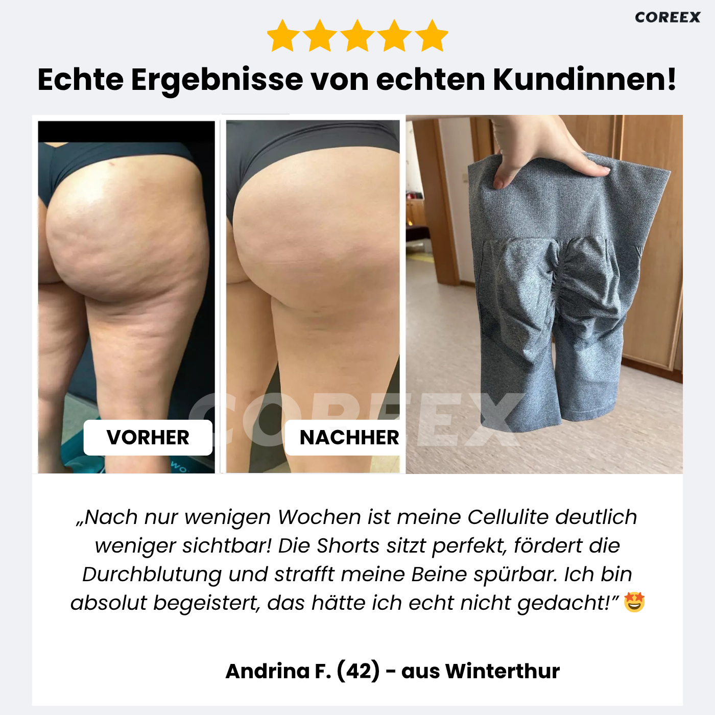 COREEX CelluFlex™ 3D-Kompressionsshorts