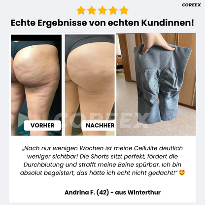 COREEX CelluFlex™ 3D-Kompressionsshorts