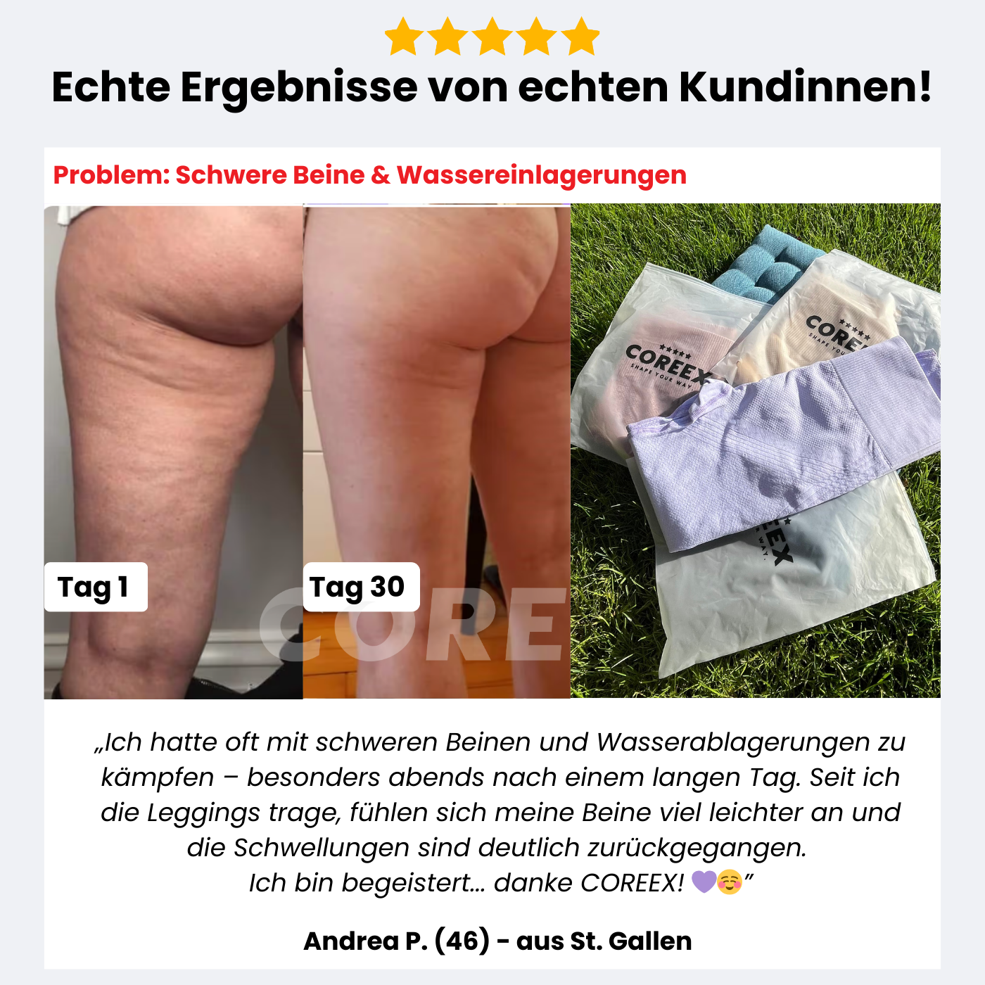 COREEX CelluFlex™ 3D-Kompressionsleggings LIMITED EDITION