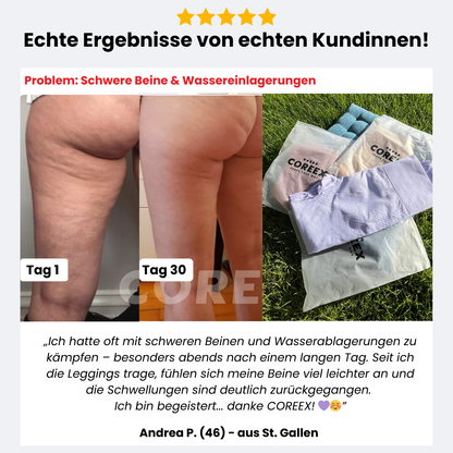 COREEX CelluFlex™ 3D-Kompressionsleggings LIMITED EDITION